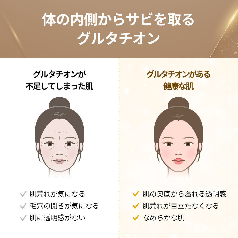 ヨエスターGLTダイレクト5X