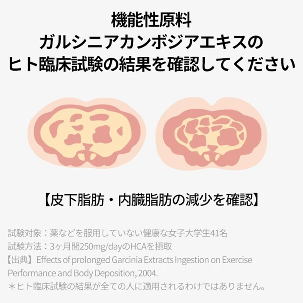 ヨエスターフィトリックスファットプロッカーガルシニア2.0